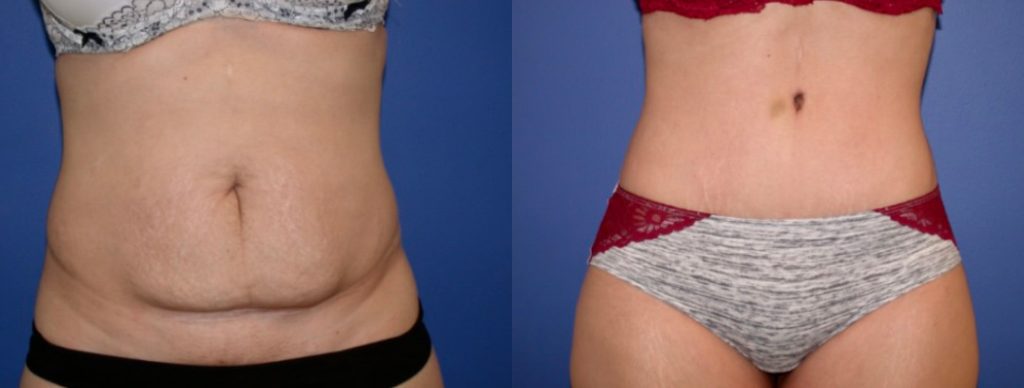 Before & After Image Before & After Image