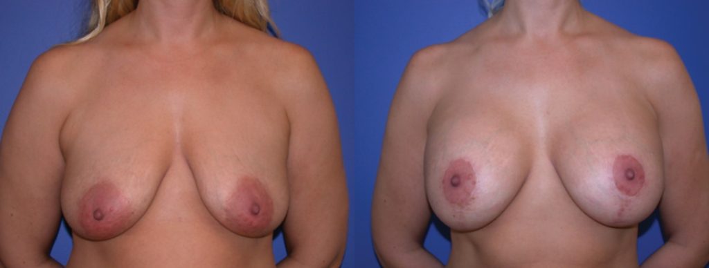 Before & After Image Before & After Image