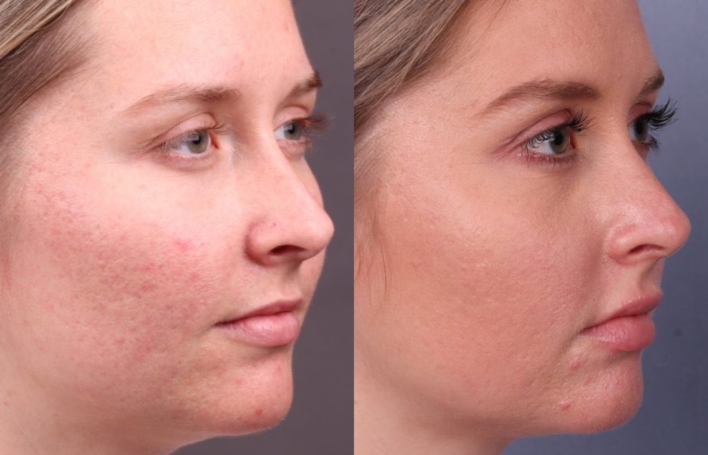 Before & After Images Before & After Images