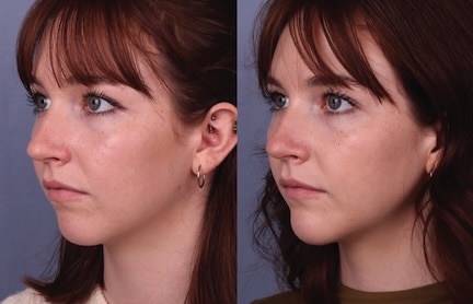 Before & After Image Before & After Image