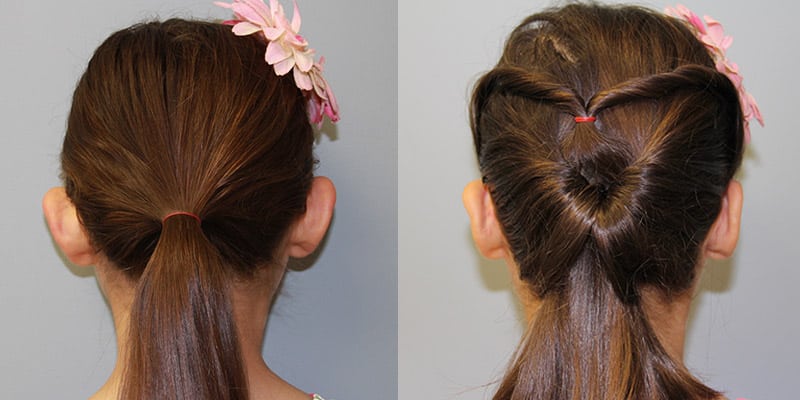 Before & After Image Before & After Image