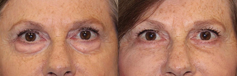 Before & After Image