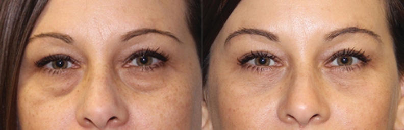 Before & After Image